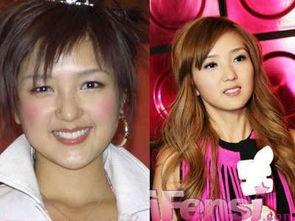 明星爆料整容视频